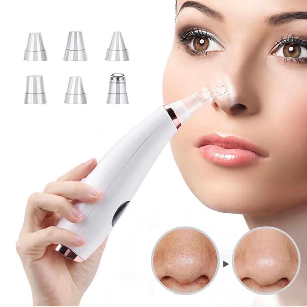 Aspirateur électrique pour points noirs, nettoyeur d'acné, élimination des taches noires, nettoyage en profondeur du visage, Machine de nettoyage des pores, outils de soins de la peau