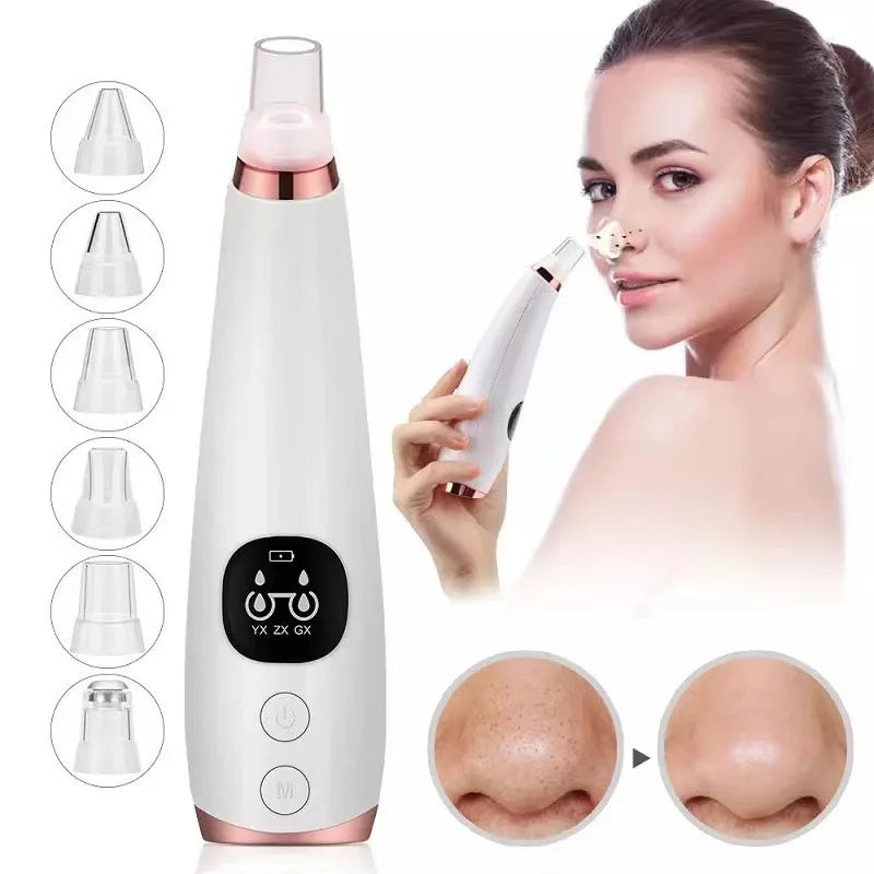 Aspirateur électrique pour points noirs, nettoyeur d'acné, élimination des taches noires, nettoyage en profondeur du visage, Machine de nettoyage des pores, outils de soins de la peau